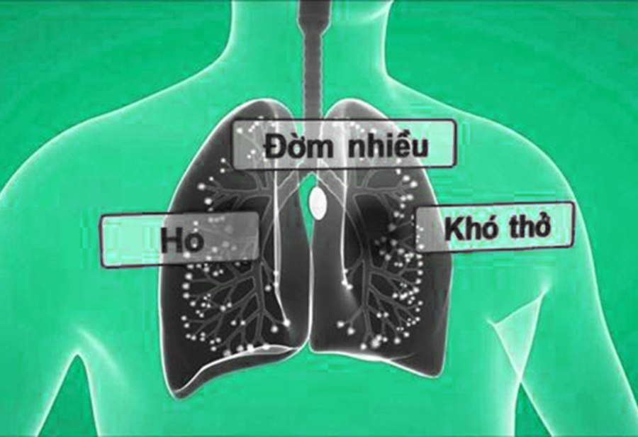Có những bệnh lý khác ngoài tim và phổi mà có thể gây ra ho khan khó thở?

