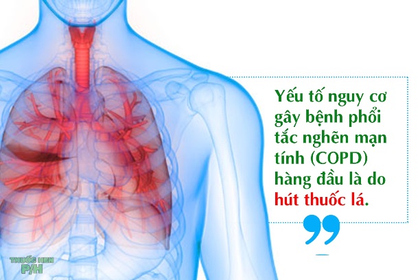 Tiền Sử Bệnh Mạn Tính Là Gì? Những Điều Bạn Cần Biết Để Bảo Vệ Sức Khỏe