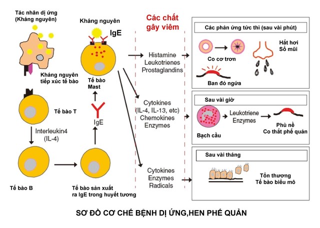 Thuốc kháng H1 có ảnh hưởng như thế nào đến viêm mũi dị ứng?
